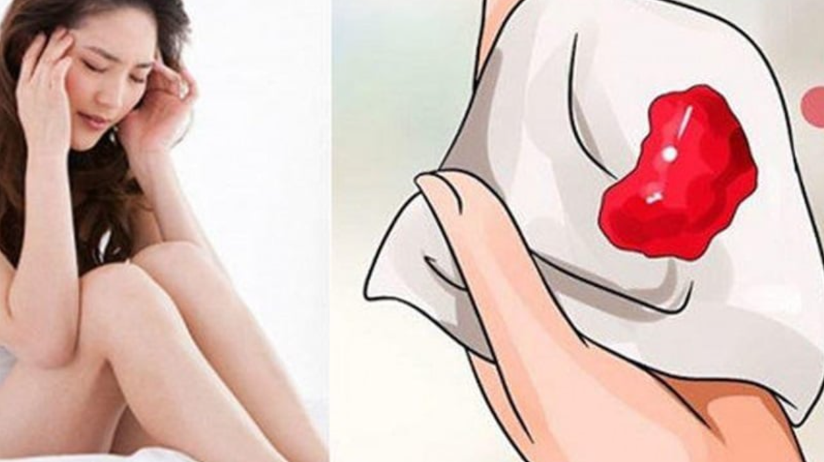 Cục máu đông trong kỳ kinh nguyệt