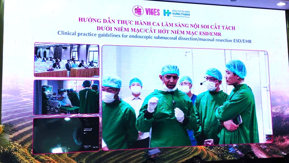 Nâng Cao Chất Lượng Nội Soi Tiêu Hóa: Hướng Tới Chuẩn Hóa Kỹ Thuật Mới