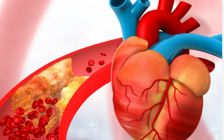 Sức Mạnh Cơ Bắp và Bệnh Tim Mạch