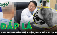 Khám Phá Ba Loại Cá Bình Dân Nhập Món Ngon Giàu Dinh Dưỡng