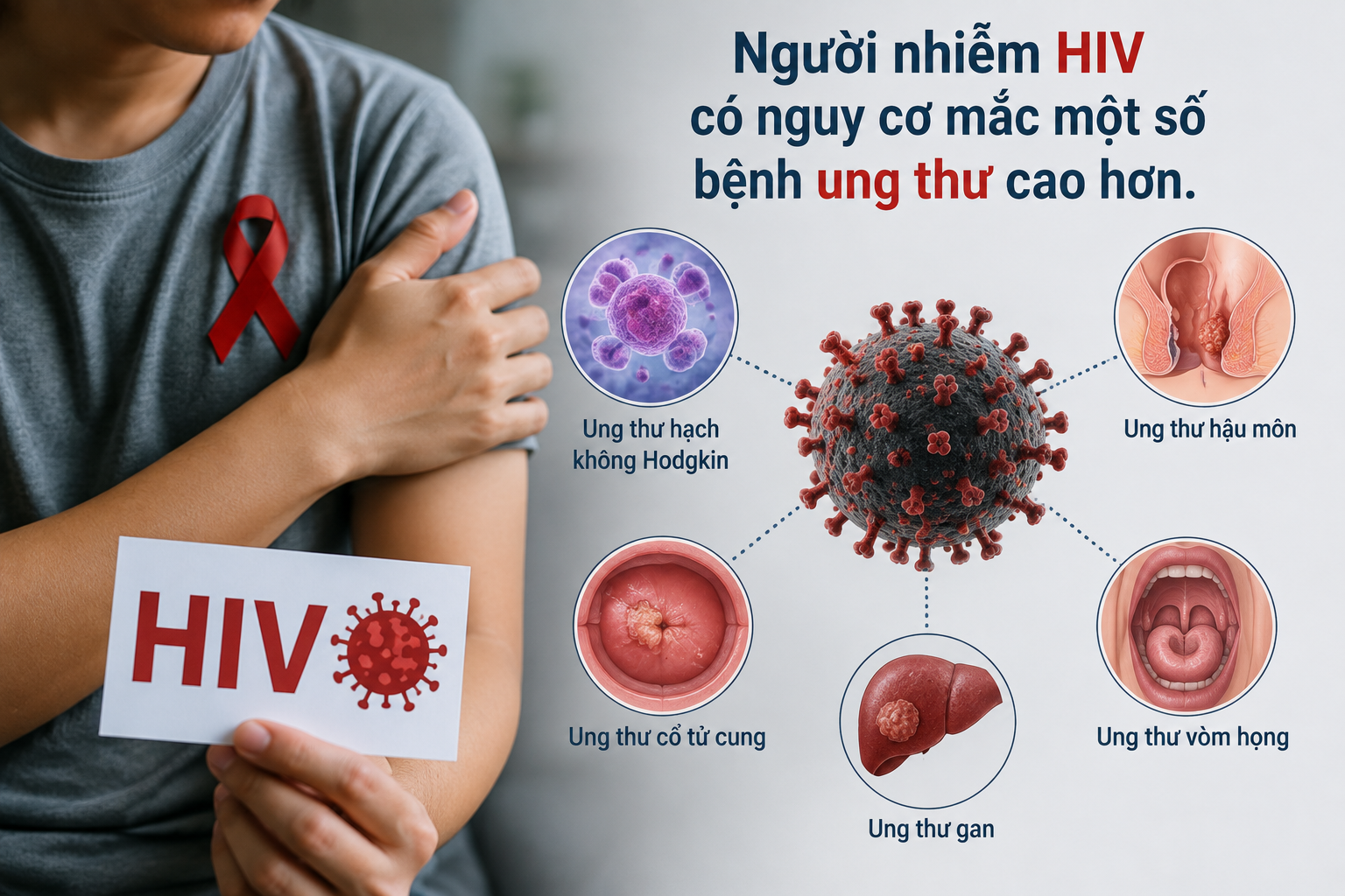 07d44539-0ad7-43a3-84d3-58b54ed66d11-17867814632211197608853 Người nhiễm HIV có cần tầm soát ung thư sớm hơn người bình thường? - Ảnh 1.