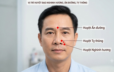 Khám Phá 5 Cách Nấu Canh Củ Sen Giàu Dinh Dưỡng