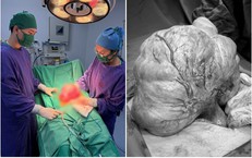 Khám Phá Cuộc Thi Về Bình Đẳng Giới Tính: Cơ Hội Tăng Cường Nhận Thức Cộng Đồng