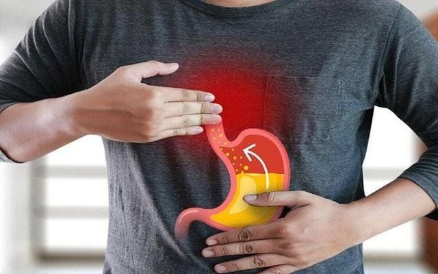 Nhận Diện và Phòng Ngừa Trào Ngược Dạ Dày – Thực Quản Hiệu Quả