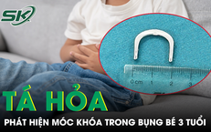 Nguy Cơ Từ Những Khoảnh Khắc Mất Tập Trung Khi Lái Xe