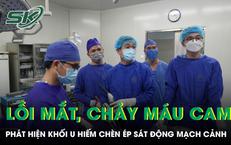 Tai Nạn Thảm Khốc: Một Người Đàn Ông Gặp Nạn Với 150 Vết Đốt Ong Vò Vẽ