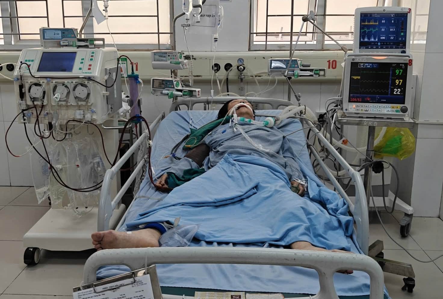 Cuộc Chiến Sinh Tử: Hành Trình 23 Ngày Của Bệnh Nhân Sốc Nhiễm Khuẩn - Ảnh 1.