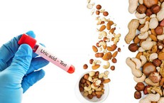 Khám Phá Nguyên Nhân Đau Nửa Đầu Tháng: Liệu Thời Tiết Hay Kỳ Kinh Là Thủ Phạm?
