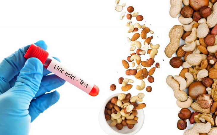Tác Động Của Mất Nước Đến Nồng Độ Acid Uric Ở Người Trên 50 Tuổi - Ảnh 1.