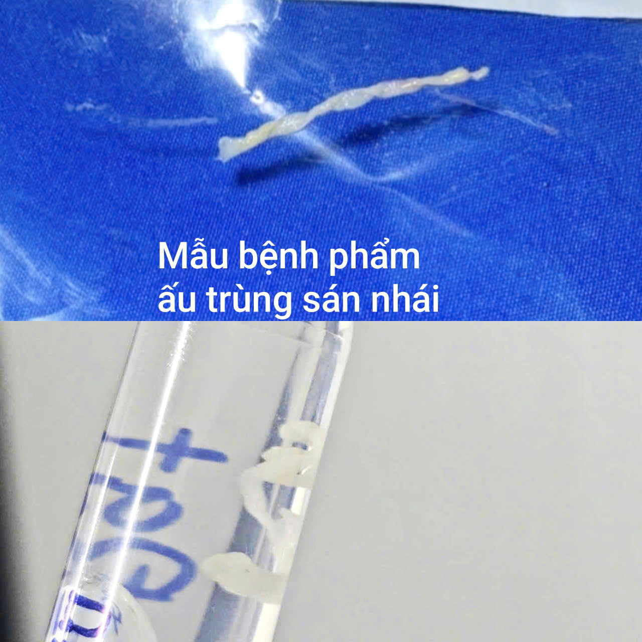 au-trung-san-nhai-17866090457232125237772 Nguy Cơ Sức Khỏe Từ Việc Uống Nước Suối Khi Bơi - Ảnh 2.