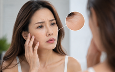 Giải Pháp Tập Luyện Dành Cho Người Trên 50 Tuổi Bị Tăng Acid Uric