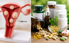 Những Thực Phẩm Bổ Sung Cần Tránh Kết Hợp Với Canxi