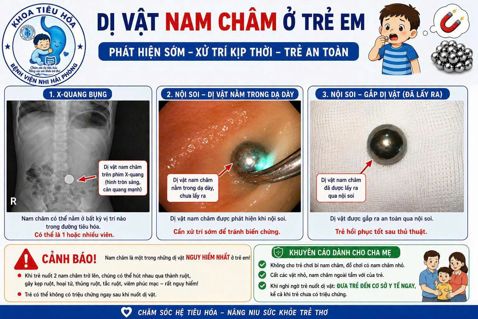 Sự Cảnh Giác Khi Trẻ Nuốt Phải Dị Vật Nam Châm: Câu Chuyện Nghẹt Thở