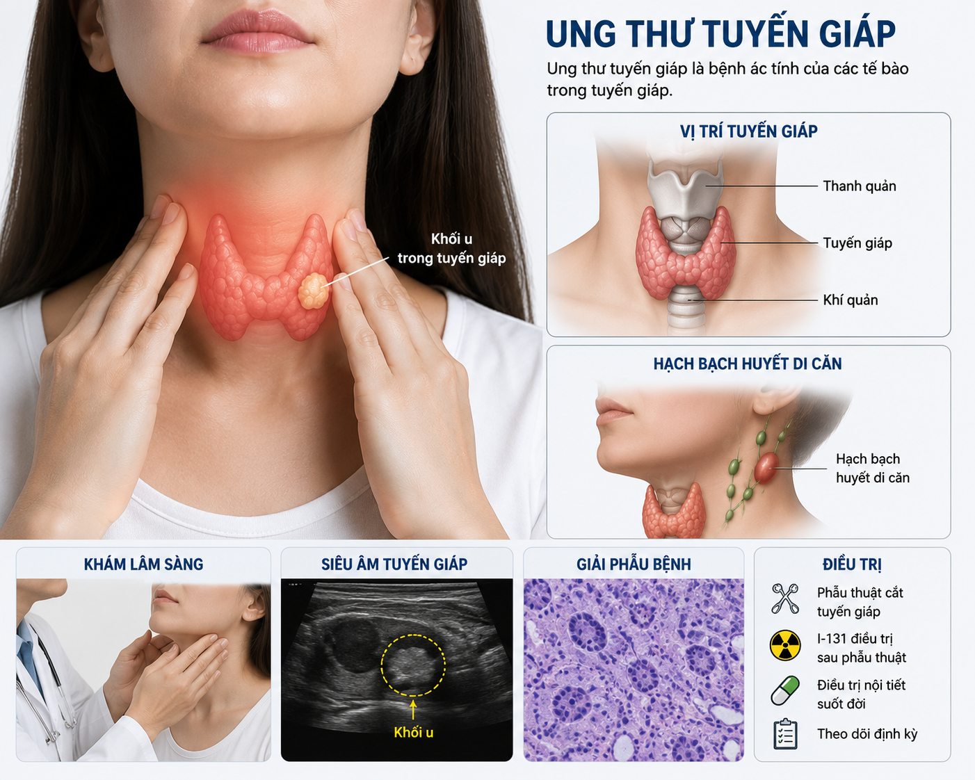 Làm thế nào để xác định cần điều trị I-131 sau phẫu thuật ung thư tuyến giáp?