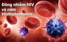 Mối Nguy Hiểm Từ Virus HPV: Nguyên Nhân Và Giải Pháp Phòng Ngừa