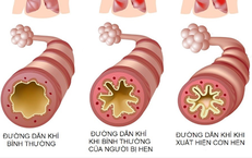 Những Dấu Hiệu Cần Nhận Biết Khi Trẻ Bị Sặc Nước