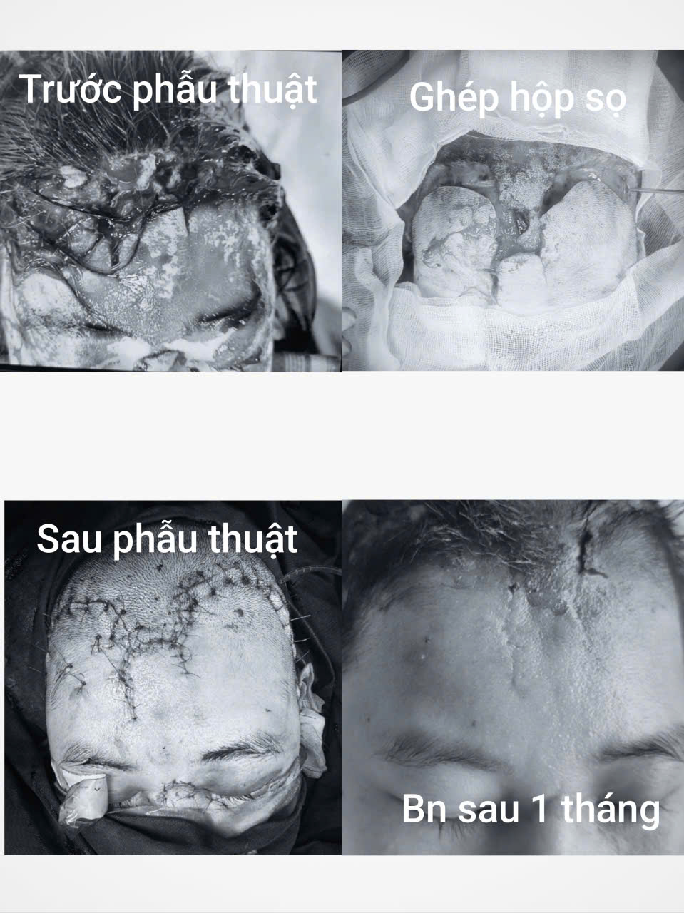 Hình ảnh chấn thương ở bệnh nhân trước và sau phẫu thuật.