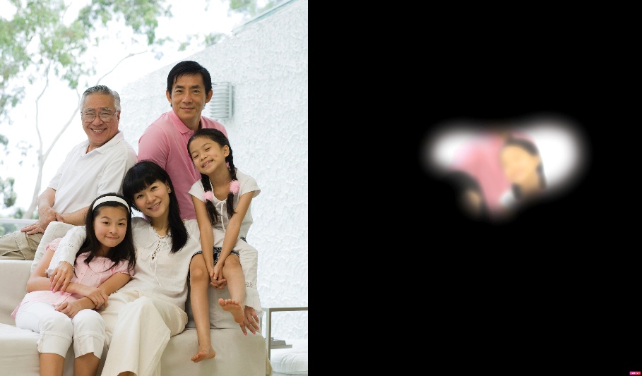 Những Nguy Cơ Mất Thị Lực Vĩnh Viễn Do Glaucoma và Cách Phòng Ngừa