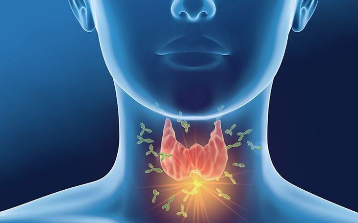 Phát Hiện Sớm Suy Giáp Ở Trẻ - Ảnh 1.
