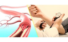 Tại Sao Khám Sức Khỏe Định Kỳ Là Cần Thiết Cho Người Lao Động Khỏe Mạnh?