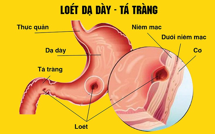 Cây Xấu Hổ: Giải Mã Những Công Dụng Y Học Đáng Chú Ý
