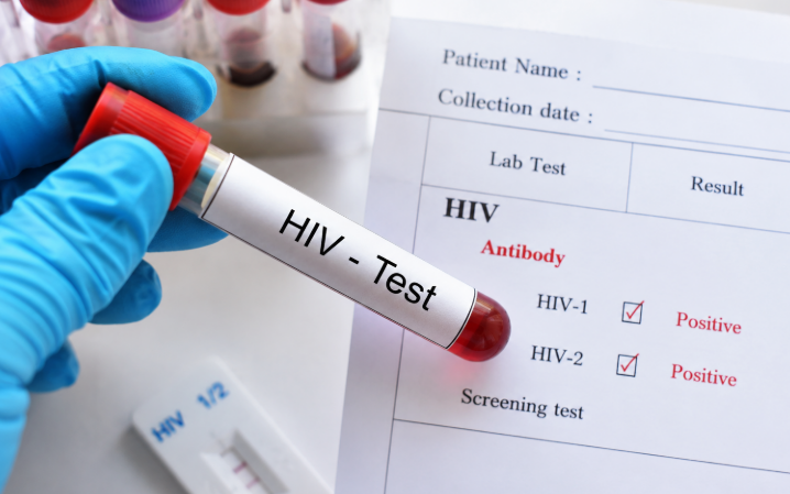 xet-nghiem-hiv-17831360355541208256748-0-0-449-718-crop-17831360390281339439346-1 HIV chưa có thuốc chữa khỏi nhưng đã có thể kiểm soát như một bệnh mạn tính - Ảnh 2.