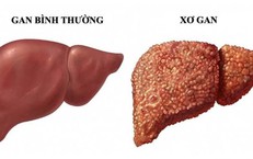 Những Tác Động Tiêu Cực Khi Làm Ca Đêm và Biện Pháp Khắc Phục