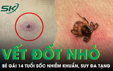 Câu Chuyện Cảnh Báo Từ Việc Ăn Đồ Hâm Lại: Những Nguy Cơ Đáng Lo Ngại