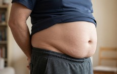 Làm săn chắc da sau 50: thói quen thiết thực để giảm chảy xệ