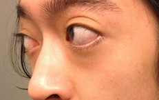 Điều Cần Lưu Ý Khi Nam Giới Bị Tim Sử Dụng Thuốc Cường Dương